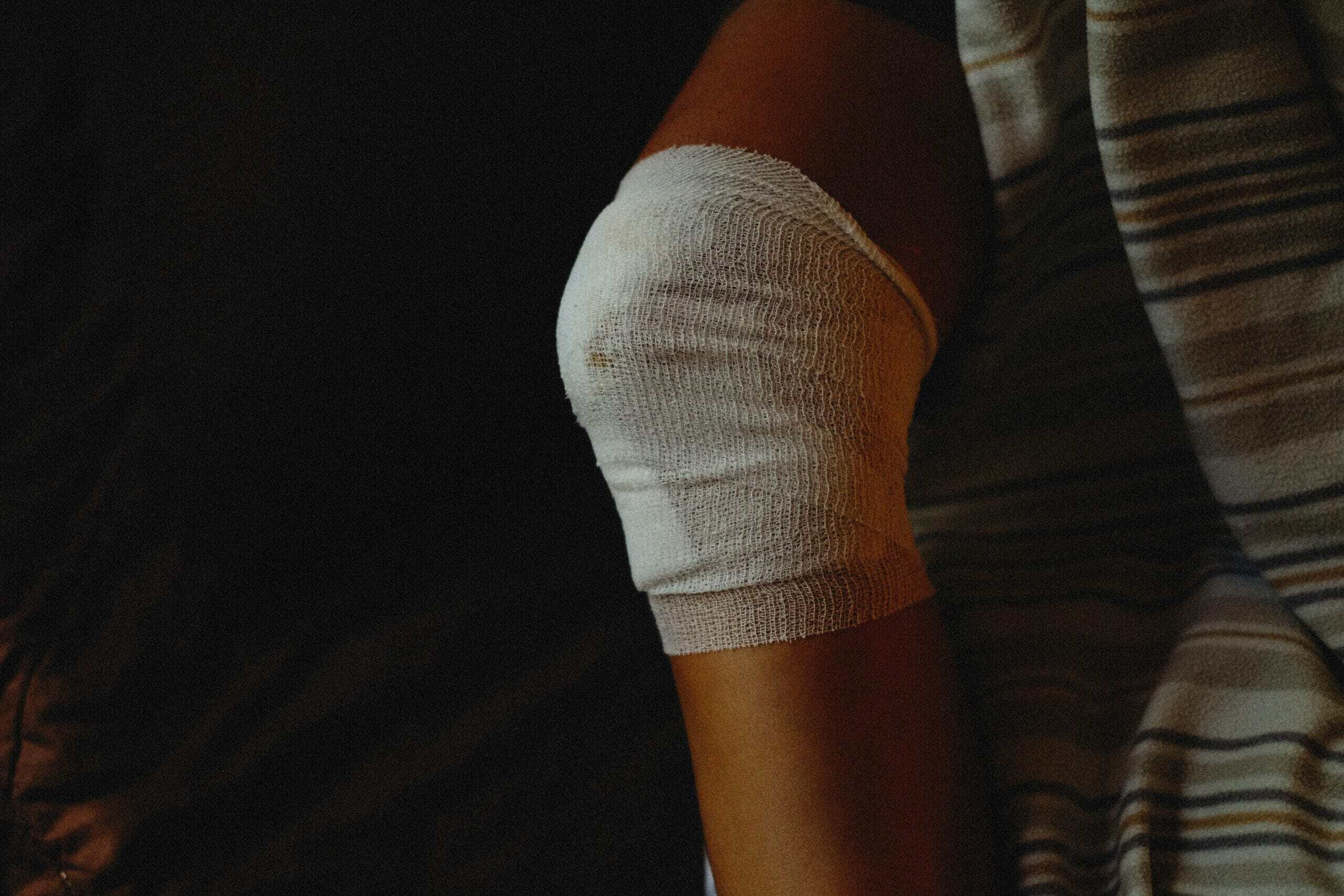 How to Sleep After Knee Replacement: The 12-Week Recovery Plan That Actually Works