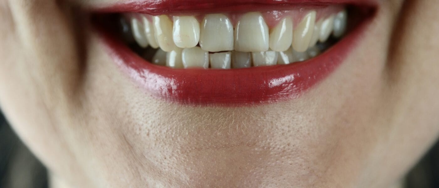 How to Stop Grinding Teeth at Night: 4 Steps Beyond the Night Guard
