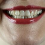 how to stop grinding teeth at night