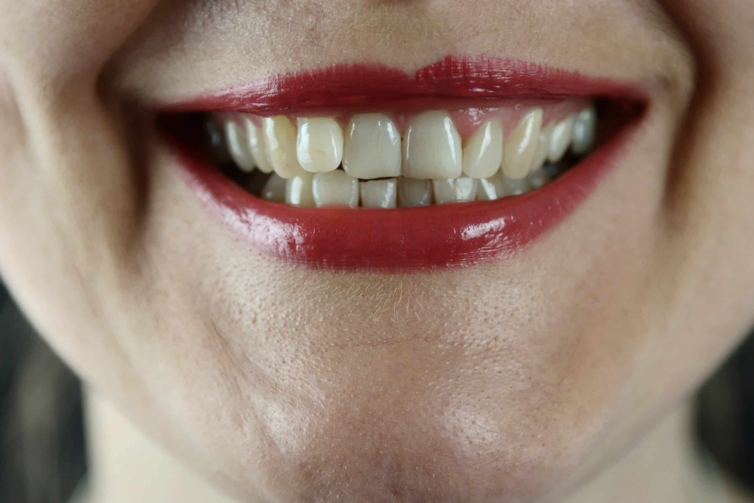 How to Stop Grinding Teeth at Night: 4 Steps Beyond the Night Guard