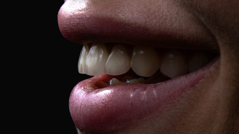 Waking Up with a Sore Jaw? Why You Grind Your Teeth at Night (and How to Stop)