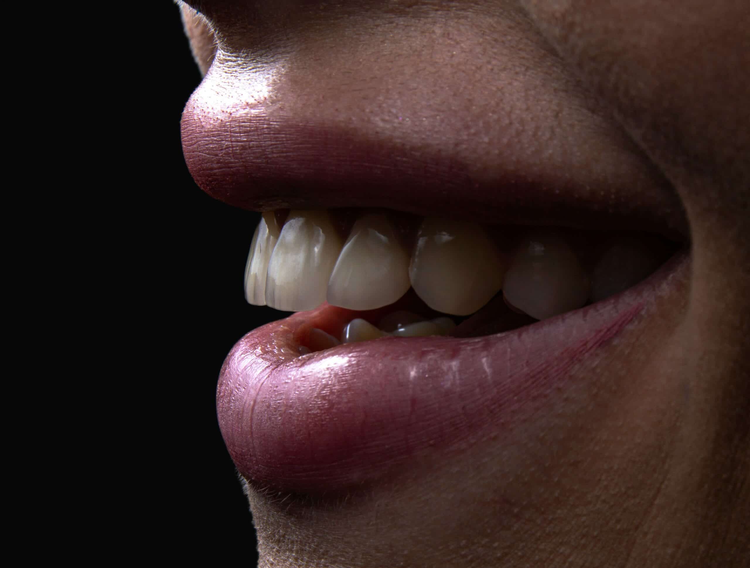 Waking Up with a Sore Jaw? Why You Grind Your Teeth at Night (and How to Stop)