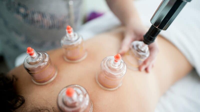 Best Cupping Sets for Muscle Tension in 2026: Suction Types, Marks, and What the Evidence Says